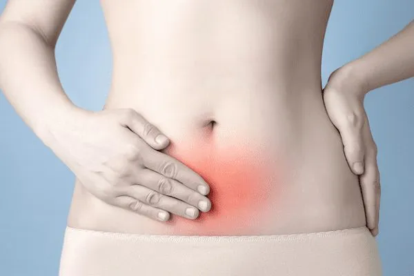 Sintomas de endometriose.