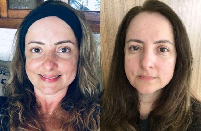 Melanesse Manutenção antes e depois.