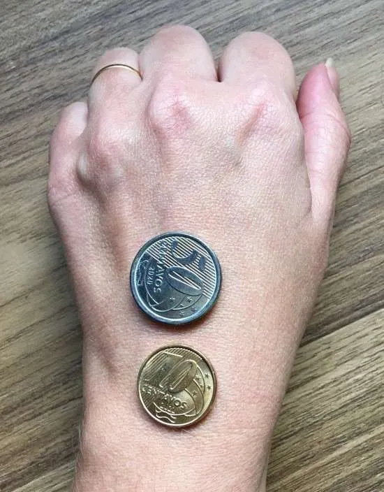 Subtom de pele: teste das moedas.