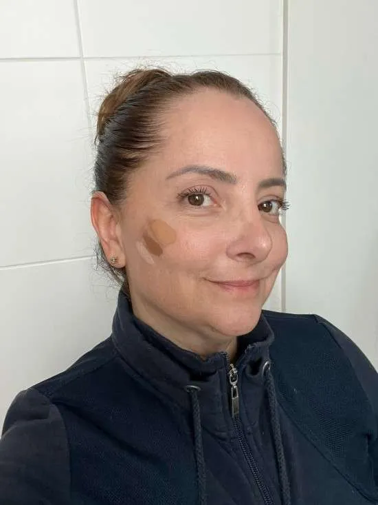 Subtom de pele o que é e como saber o seu.