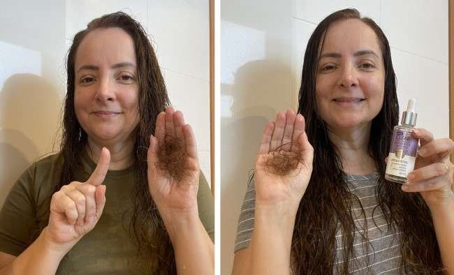 Antiqueda Clear Derma Solutions - antes e depois.