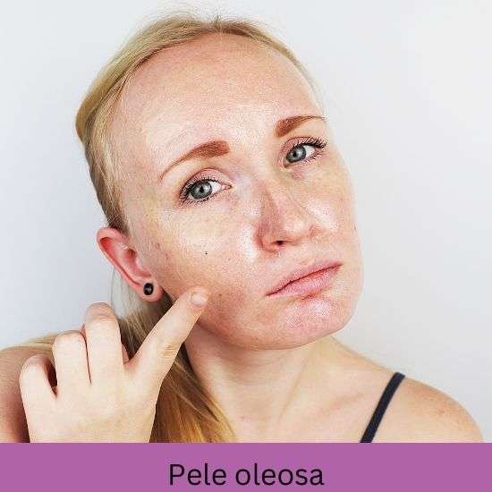 Pele oleosa.